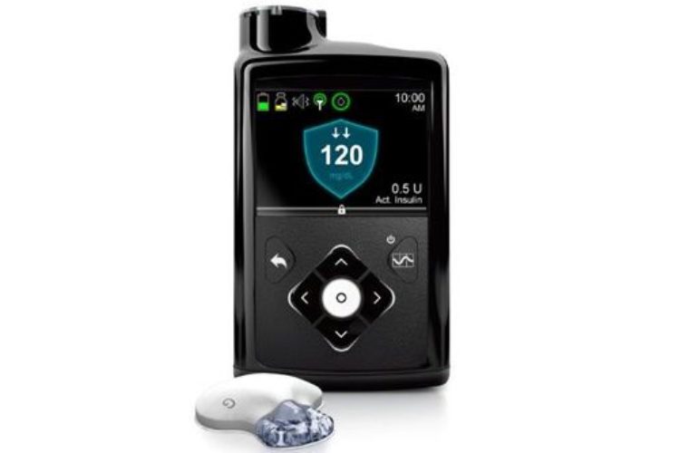 Why the Medtronic 670G Artificial Pancreas is a huge deal for diabetes
