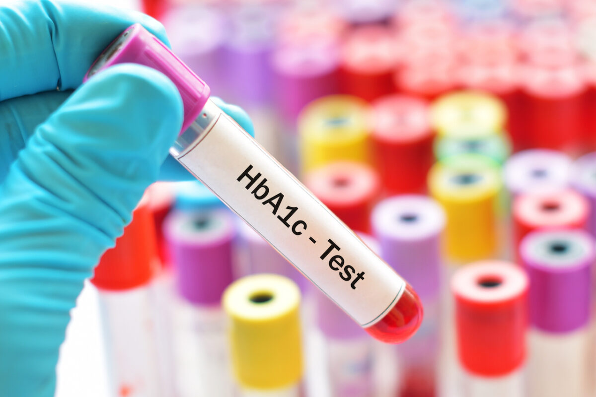 It’s Not Just About Your A1c