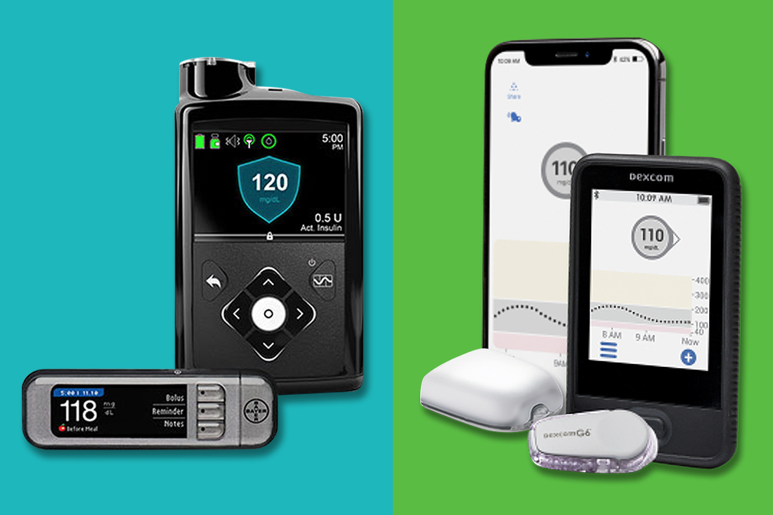 dexcom minimed