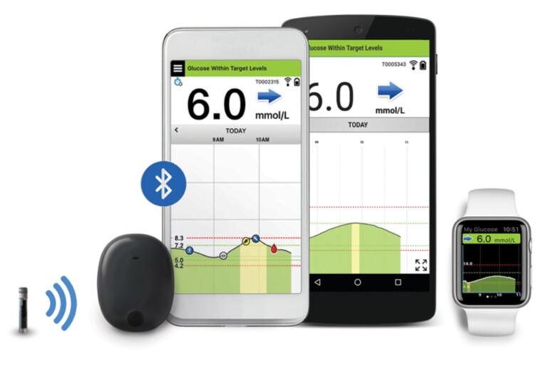 39 Potential New Continuous Glucose Monitors for Diabetes