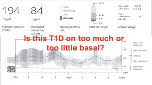 T1D basal insulin case study