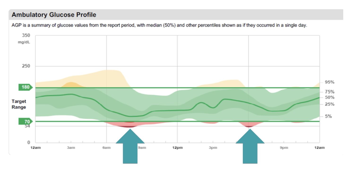 The Case of the Club Med Scuba Instructor Whose Blood Sugars Took a
