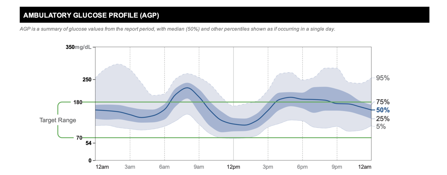 The Timing of Insulin Administration Don’t Shoot Your Wad Too Late