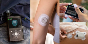 Diabetes devices include the Medtronic 780G, Dexcom G7 CGM and Tandem insulin pump