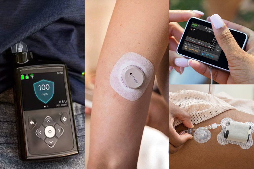 Diabetes devices include insulin pumps and continuous glucose monitors