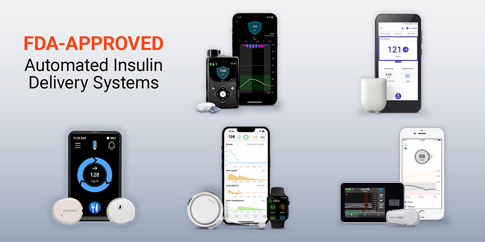 Automated insulin delivery hybrid closed-loop systems for diabetes