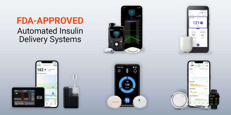 Automated Insulin Delivery Systems: A Complete Guide