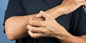 Man with diabetes and itchy skin