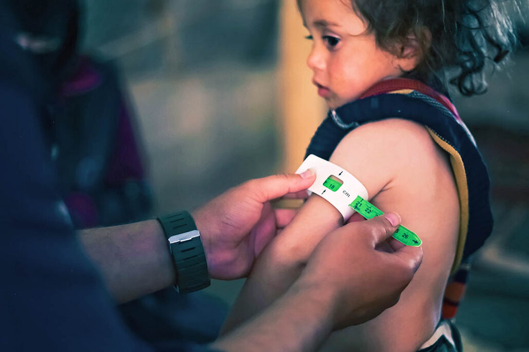 A doctor takes an arm measurement of a young, malnourished child