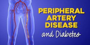 An anatomical illustration of a human lower body, focusing on the arterial system of the legs.