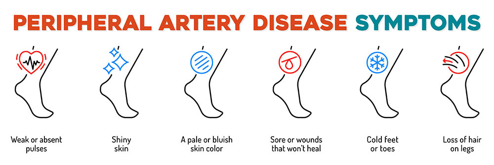 drawings of symptoms for peripheral artery disease, including weak pulses, shiny skin, wounds that won't heal, and cold feet or toes.