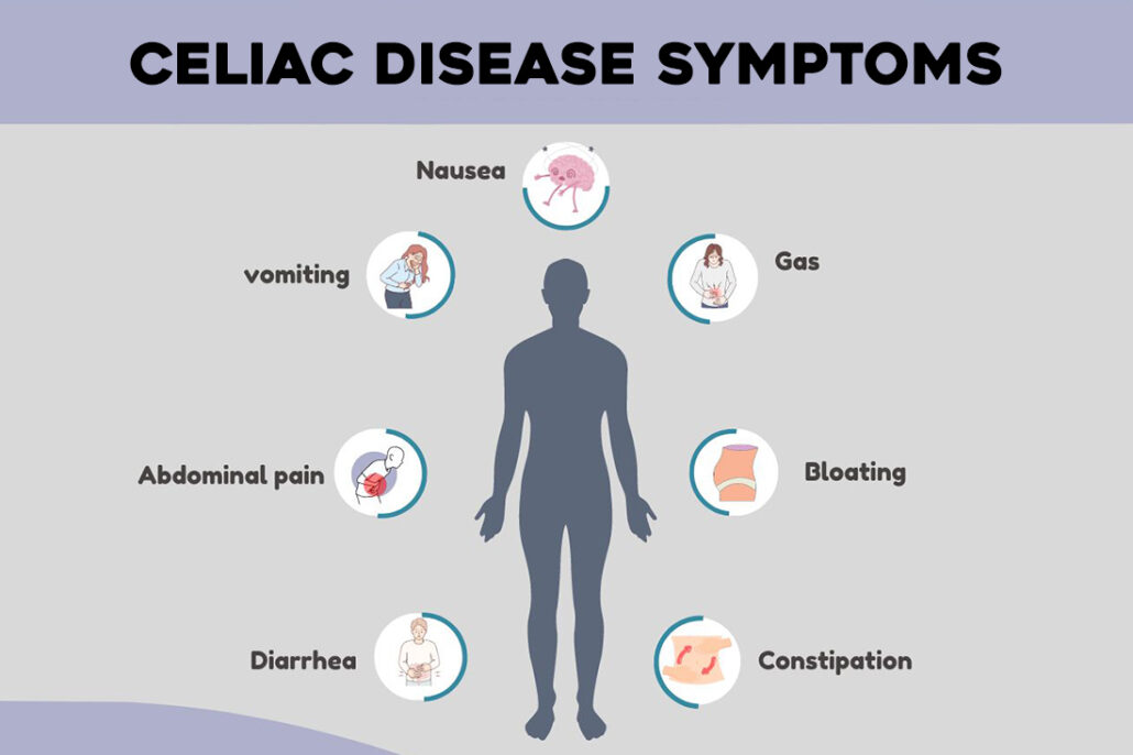 A list of some of the symptoms of celiac disease, including nausea, vomiting, abdominal pain, gas, bloating, diarrhea, and constipation
