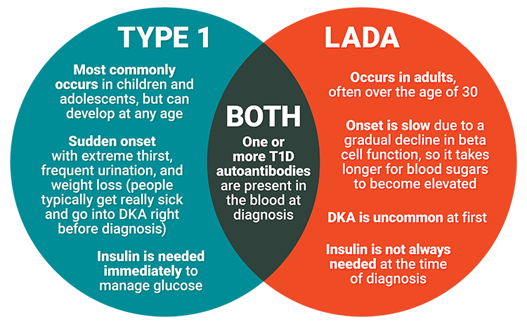 A list of differences between classic type 1 diabetes and latent autoimmune diabetes in adults (LADA)