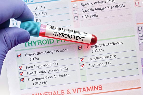 A glass tube with blood in it has a label that reads "thyroid test" and sits on top of thyroid test paperwork